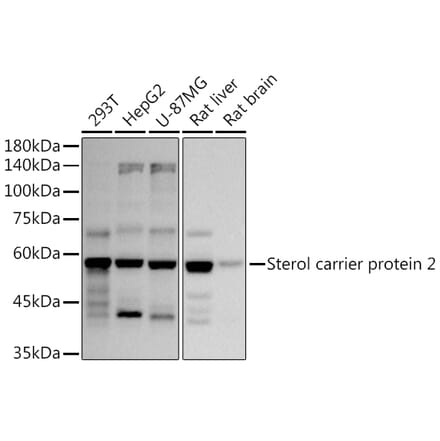 Western Blot - Anti-Sterol carrier protein 2 Antibody [ARC2735] (A307865) - Antibodies.com