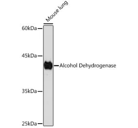 Western Blot - Anti-Alcohol Dehydrogenase Antibody [ARC2203] (A307868) - Antibodies.com