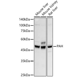Western Blot - Anti-PAH Antibody [ARC2936] (A307869) - Antibodies.com