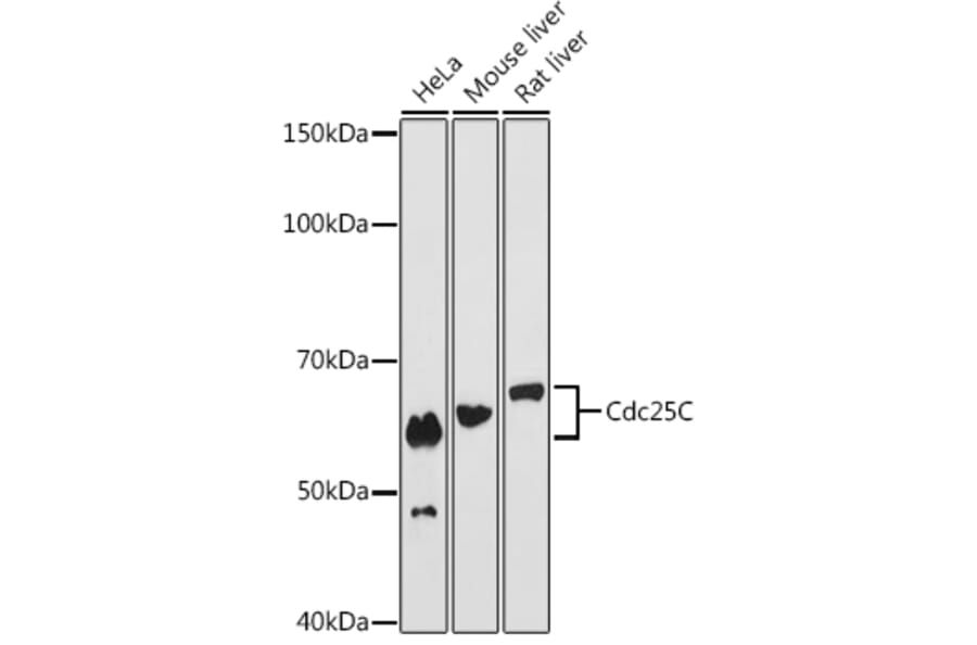 Western Blot - Anti-Cdc25C Antibody [ARC0622] (A307870) - Antibodies.com