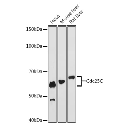 Western Blot - Anti-Cdc25C Antibody [ARC0622] (A307870) - Antibodies.com