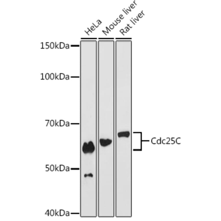 Western Blot - Anti-Cdc25C Antibody [ARC0622] (A307870) - Antibodies.com