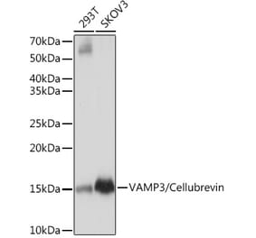 Western Blot - Anti-Cellubrevin Antibody [ARC1312] (A307871) - Antibodies.com