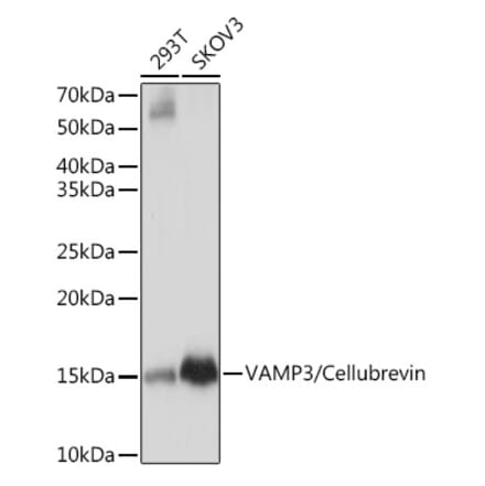 Western Blot - Anti-Cellubrevin Antibody [ARC1312] (A307871) - Antibodies.com