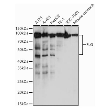 Western Blot - Anti-Filaggrin Antibody (A307872) - Antibodies.com
