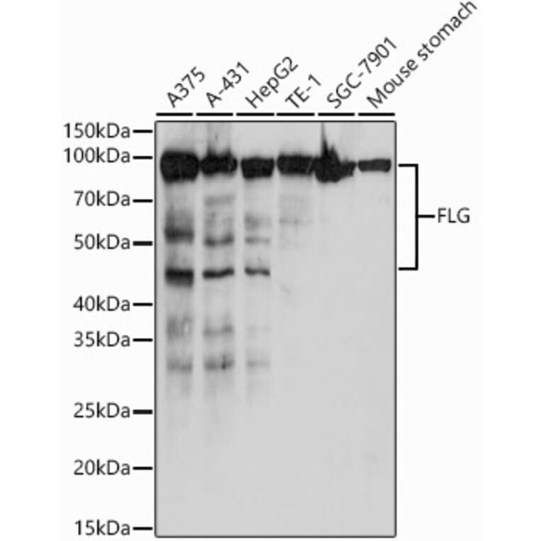 Western Blot - Anti-Filaggrin Antibody (A307872) - Antibodies.com