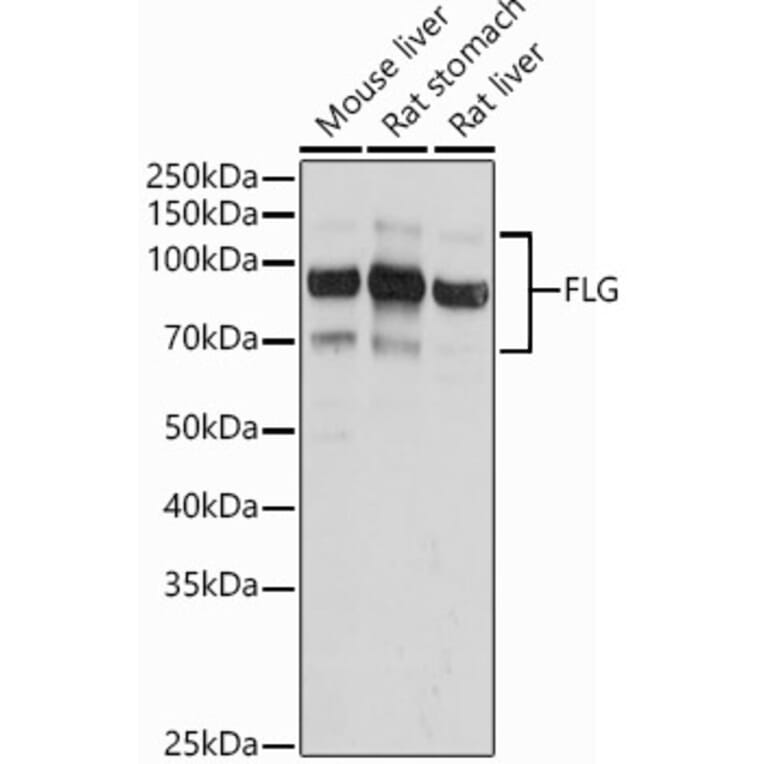 Western Blot - Anti-Filaggrin Antibody (A307872) - Antibodies.com