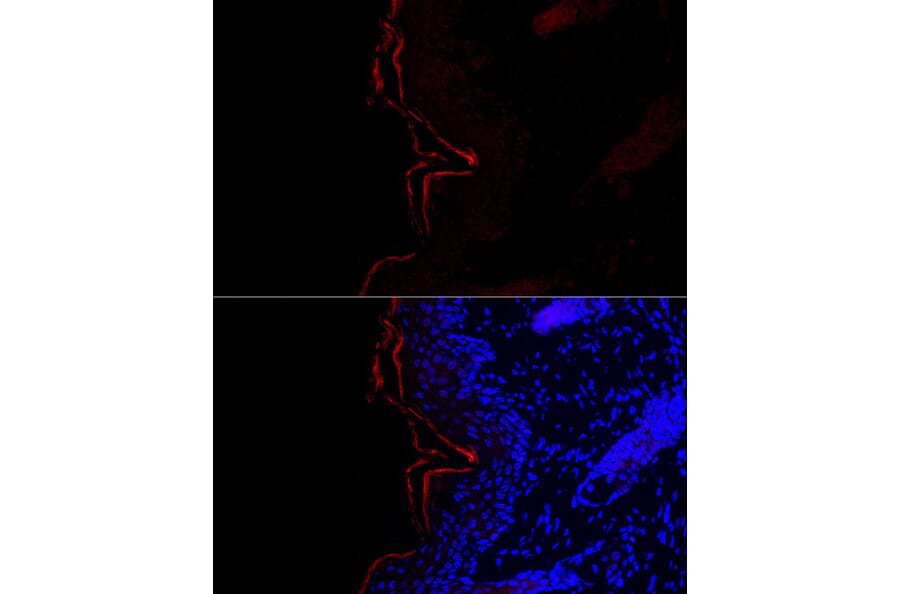 Immunofluorescence - Anti-Filaggrin Antibody (A307872) - Antibodies.com