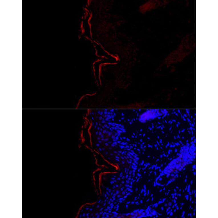 Immunofluorescence - Anti-Filaggrin Antibody (A307872) - Antibodies.com