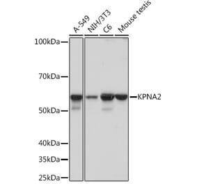 Western Blot - Anti-KPNA2 Antibody [ARC1227] (A307873) - Antibodies.com