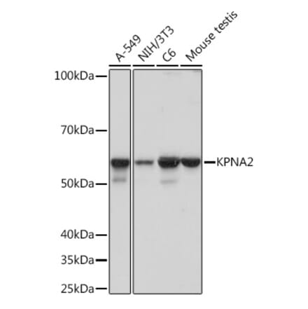 Western Blot - Anti-KPNA2 Antibody [ARC1227] (A307873) - Antibodies.com