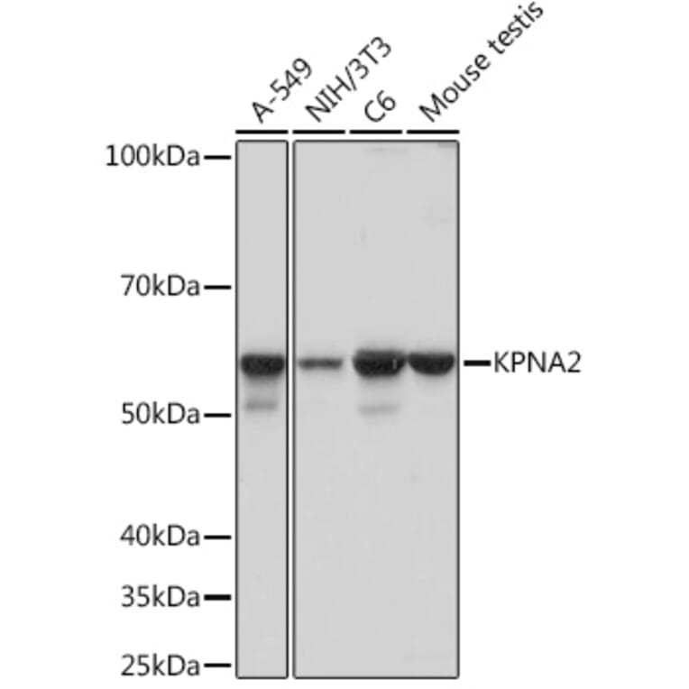 Western Blot - Anti-KPNA2 Antibody [ARC1227] (A307873) - Antibodies.com