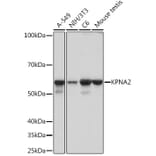 Western Blot - Anti-KPNA2 Antibody [ARC1227] (A307873) - Antibodies.com