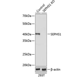 Western Blot - Anti-Selenophosphate synthetase 1 Antibody (A307875) - Antibodies.com