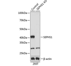 Western Blot - Anti-Selenophosphate synthetase 1 Antibody (A307876) - Antibodies.com