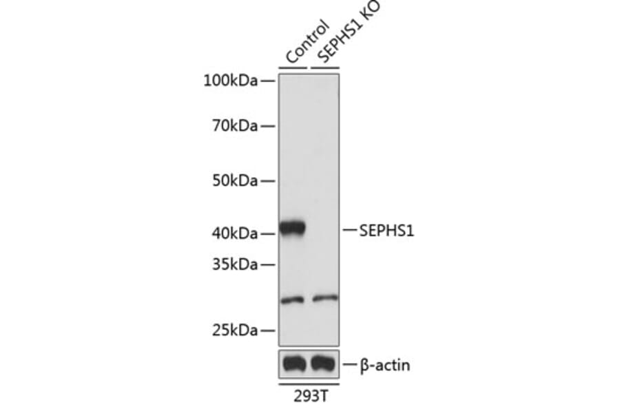 Western Blot - Anti-Selenophosphate synthetase 1 Antibody (A307876) - Antibodies.com