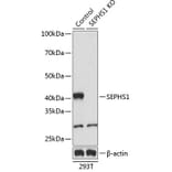 Western Blot - Anti-Selenophosphate synthetase 1 Antibody (A307876) - Antibodies.com