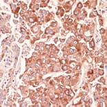 Immunohistochemistry - Anti-Mark3 Antibody (A307877) - Antibodies.com