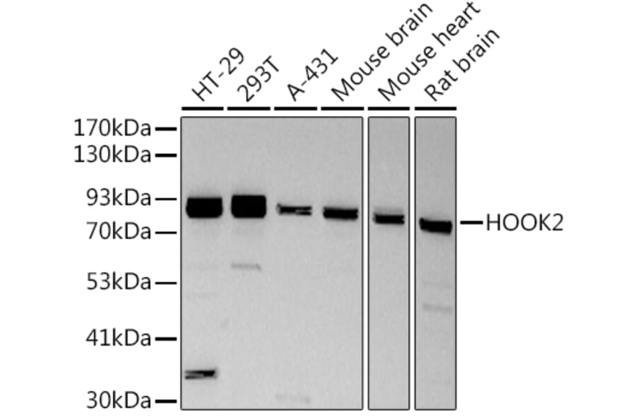 Western Blot - Anti-HOOK2 Antibody [ARC2769] (A307881) - Antibodies.com