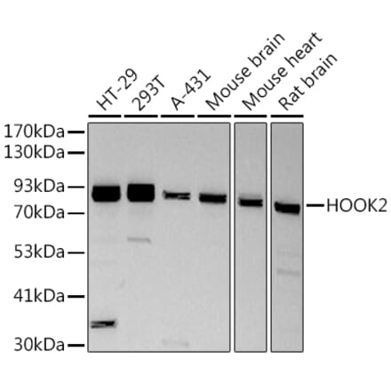 Western Blot - Anti-HOOK2 Antibody [ARC2769] (A307881) - Antibodies.com