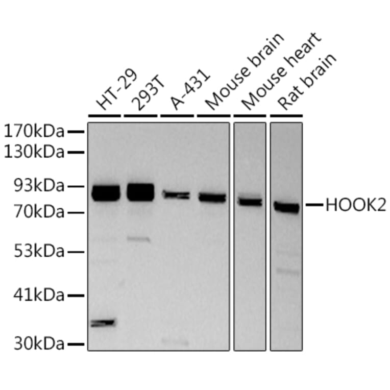 Western Blot - Anti-HOOK2 Antibody [ARC2769] (A307881) - Antibodies.com