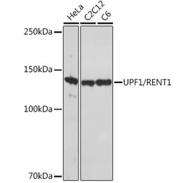Western Blot - Anti-RENT1/hUPF1 Antibody [ARC1268] (A307882) - Antibodies.com