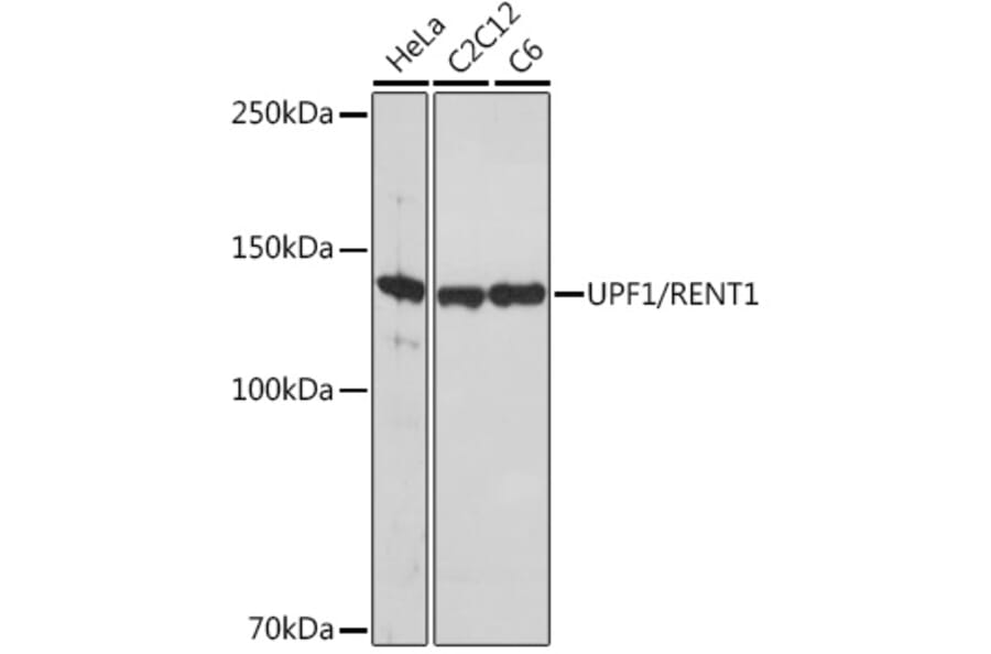 Western Blot - Anti-RENT1/hUPF1 Antibody [ARC1268] (A307882) - Antibodies.com