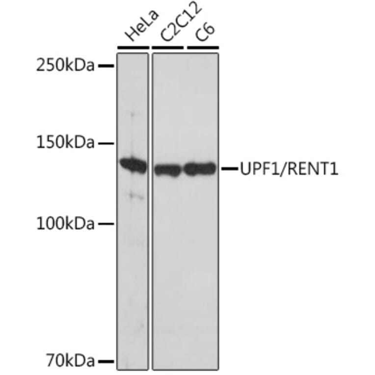 Western Blot - Anti-RENT1/hUPF1 Antibody [ARC1268] (A307882) - Antibodies.com