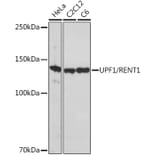 Western Blot - Anti-RENT1/hUPF1 Antibody [ARC1268] (A307882) - Antibodies.com