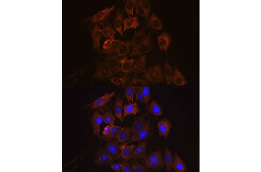 Immunofluorescence - Anti-RENT1/hUPF1 Antibody [ARC1268] (A307882) - Antibodies.com