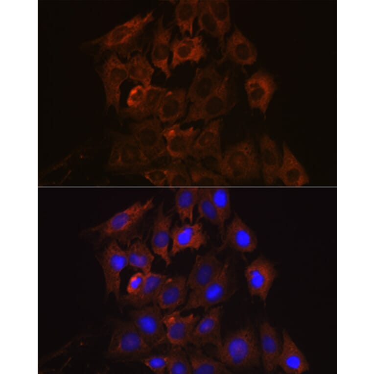 Immunofluorescence - Anti-RENT1/hUPF1 Antibody [ARC1268] (A307882) - Antibodies.com