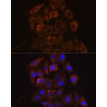 Immunofluorescence - Anti-RENT1/hUPF1 Antibody [ARC1268] (A307882) - Antibodies.com