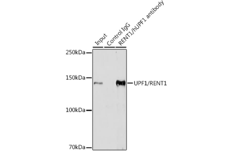 Western Blot - Anti-RENT1/hUPF1 Antibody [ARC1268] (A307882) - Antibodies.com