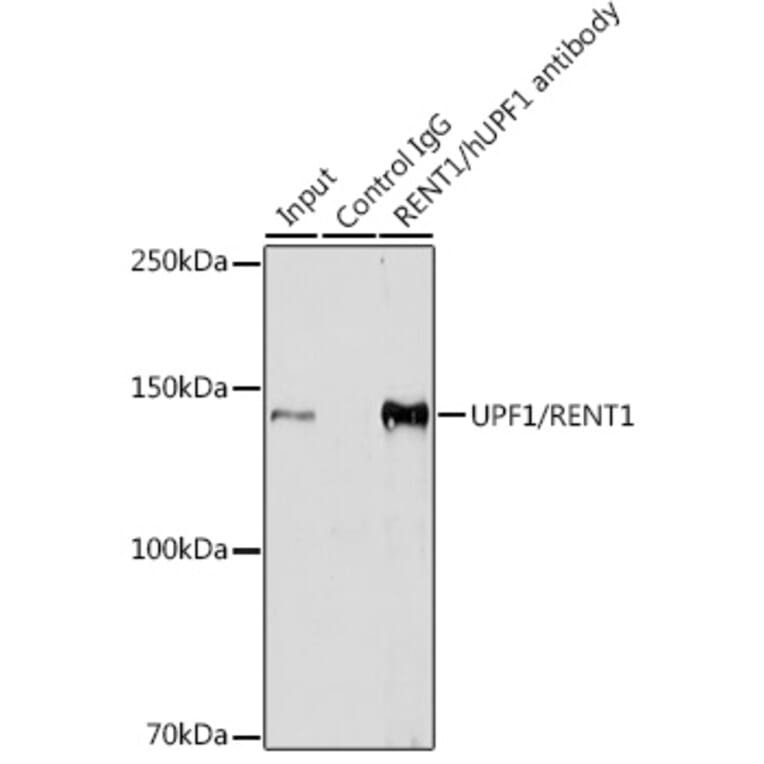 Western Blot - Anti-RENT1/hUPF1 Antibody [ARC1268] (A307882) - Antibodies.com