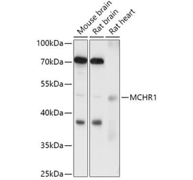 Western Blot - Anti-MCHR-1 Antibody (A307883) - Antibodies.com