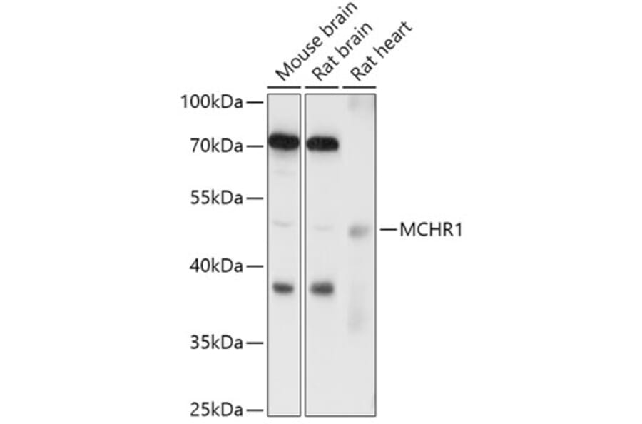 Western Blot - Anti-MCHR-1 Antibody (A307883) - Antibodies.com