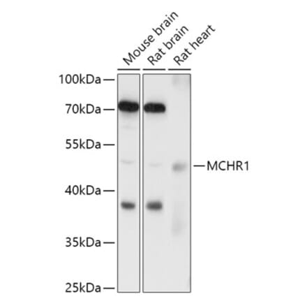 Western Blot - Anti-MCHR-1 Antibody (A307883) - Antibodies.com