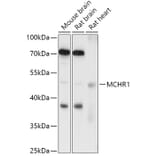 Western Blot - Anti-MCHR-1 Antibody (A307883) - Antibodies.com