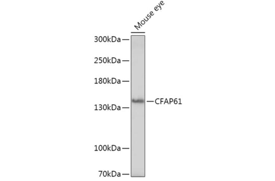 Western Blot - Anti-C20orf26 Antibody (A307884) - Antibodies.com