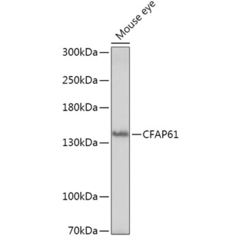 Western Blot - Anti-C20orf26 Antibody (A307884) - Antibodies.com