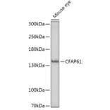 Western Blot - Anti-C20orf26 Antibody (A307884) - Antibodies.com