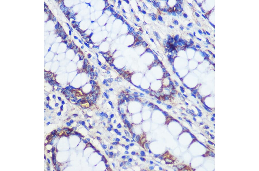 Immunohistochemistry - Anti-C20orf26 Antibody (A307884) - Antibodies.com