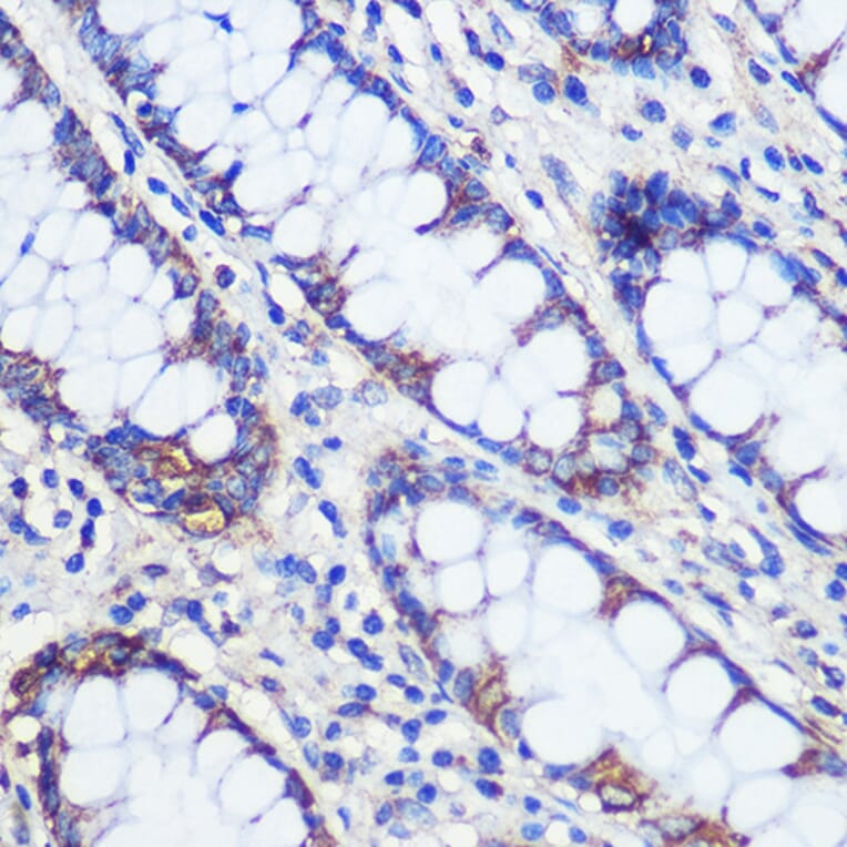 Immunohistochemistry - Anti-C20orf26 Antibody (A307884) - Antibodies.com