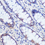 Immunohistochemistry - Anti-C20orf26 Antibody (A307884) - Antibodies.com