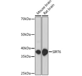 Western Blot - Anti-SIRT6 Antibody (A307885) - Antibodies.com