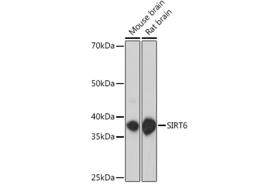 Western Blot - Anti-SIRT6 Antibody (A307885) - Antibodies.com