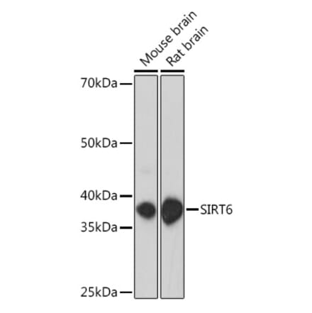 Western Blot - Anti-SIRT6 Antibody (A307885) - Antibodies.com