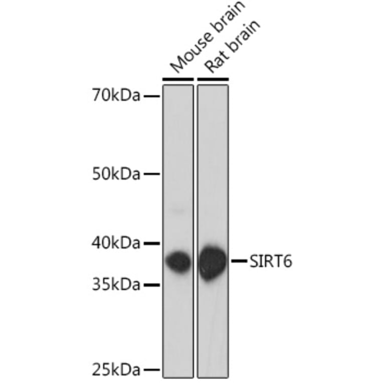 Western Blot - Anti-SIRT6 Antibody (A307885) - Antibodies.com