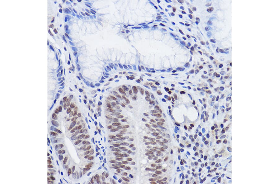 Immunohistochemistry - Anti-SIRT6 Antibody (A307885) - Antibodies.com