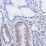 Immunohistochemistry - Anti-SIRT6 Antibody (A307885) - Antibodies.com